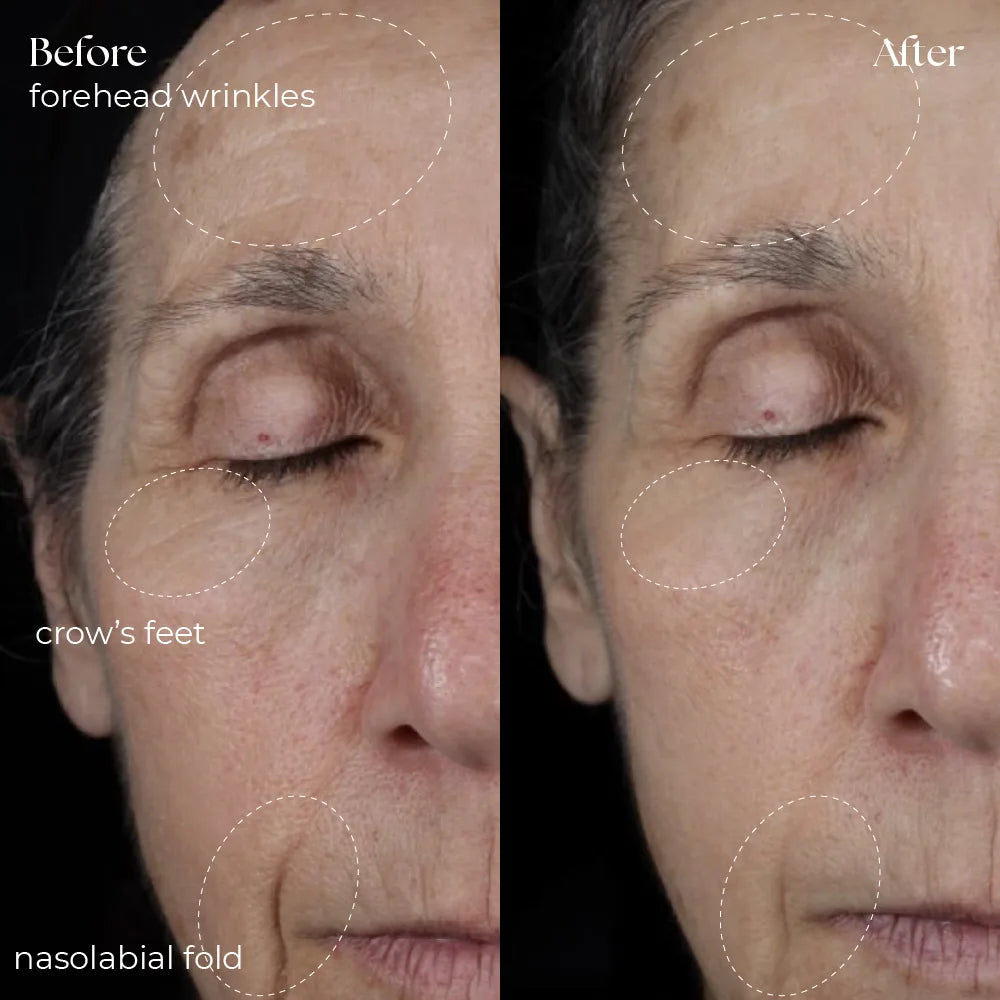 GlowLift™ | 5-In-One Sculptor & Radiance Booster