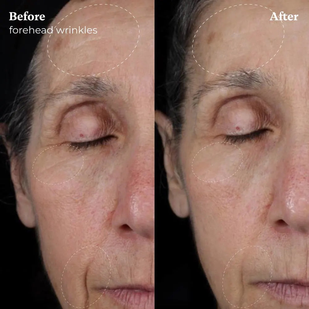 GlowLift™ | 5-In-One Sculptor & Radiance Booster + Free Serum