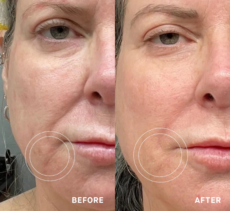 Rachel, 61