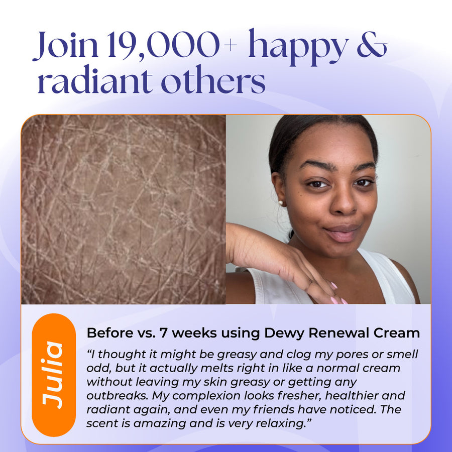 Dewy Renewal Talgcreme, Orange & Bergamotte